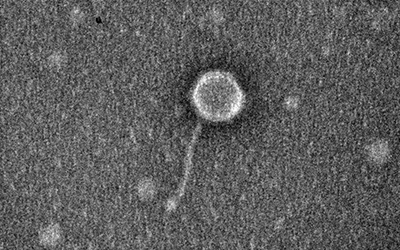 Dignity phage
